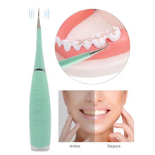 Carregar imagem no visualizador da galeria, Dental Clean™