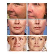 Carregar imagem no visualizador da galeria, Creme Facial e Pescoço Lifting Anti Aging - Breylee®
